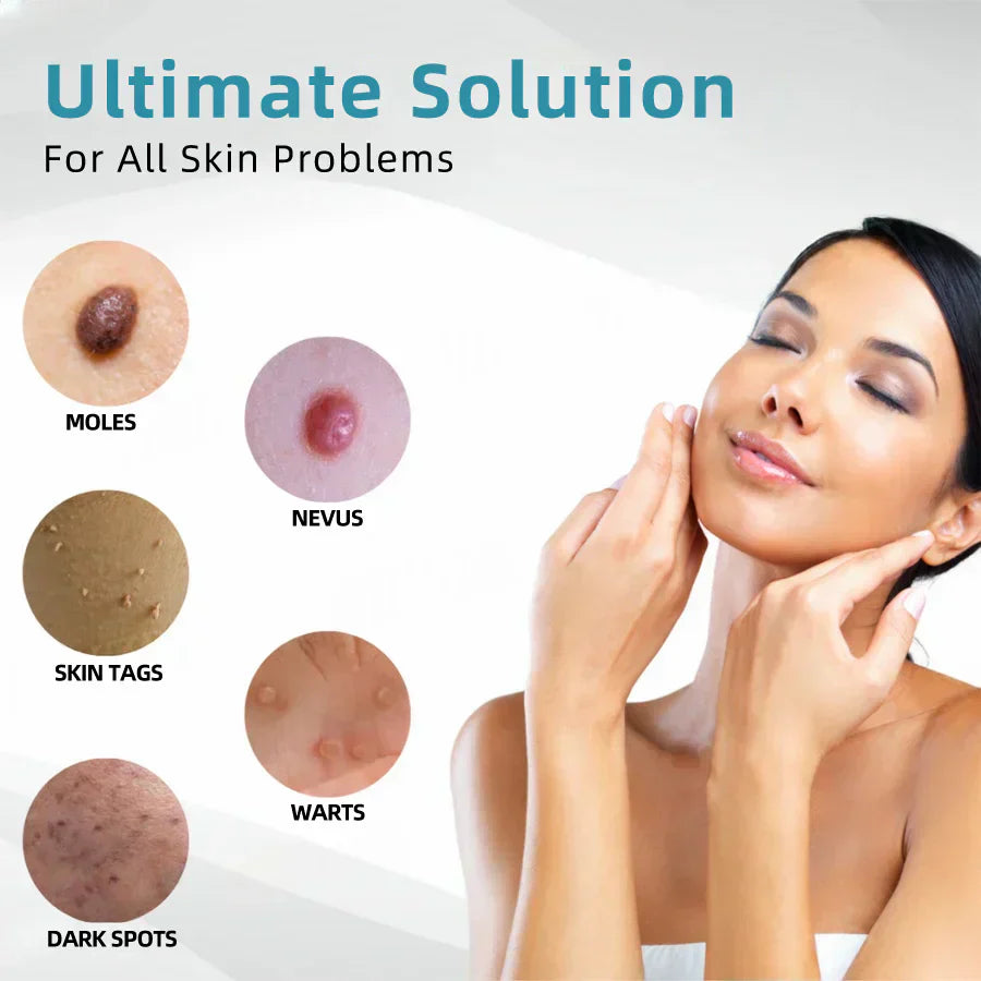 ☂Sparksalezoner® VelvetSkin+Series ⚔️All-in-One Laser Eraser Pen🖊️ (🔬Powered by CO₂ laser technology – effectively removes moles, warts, skin tags, pigmentation spots, and other skin imperfections)