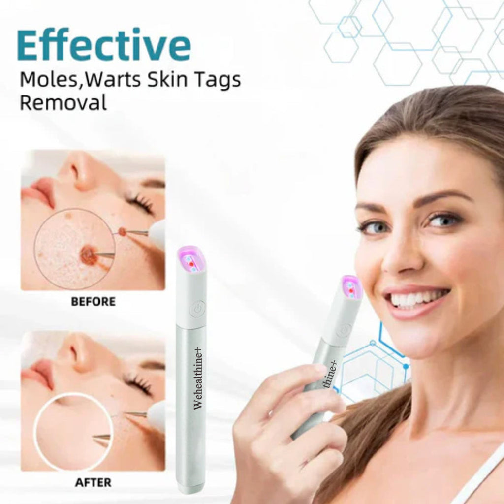 ☂Sparksalezoner® VelvetSkin+Series ⚔️All-in-One Laser Eraser Pen🖊️ (🔬Powered by CO₂ laser technology – effectively removes moles, warts, skin tags, pigmentation spots, and other skin imperfections)