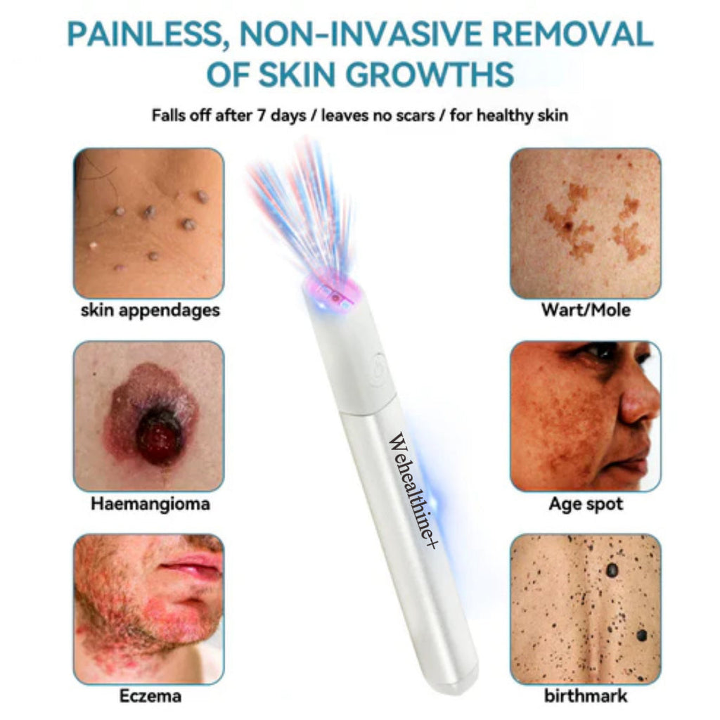 ☂Sparksalezoner® VelvetSkin+Series ⚔️All-in-One Laser Eraser Pen🖊️ (🔬Powered by CO₂ laser technology – effectively removes moles, warts, skin tags, pigmentation spots, and other skin imperfections)