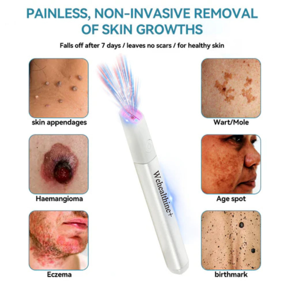 ☂Sparksalezoner® VelvetSkin+Series ⚔️All-in-One Laser Eraser Pen🖊️ (🔬Powered by CO₂ laser technology – effectively removes moles, warts, skin tags, pigmentation spots, and other skin imperfections)