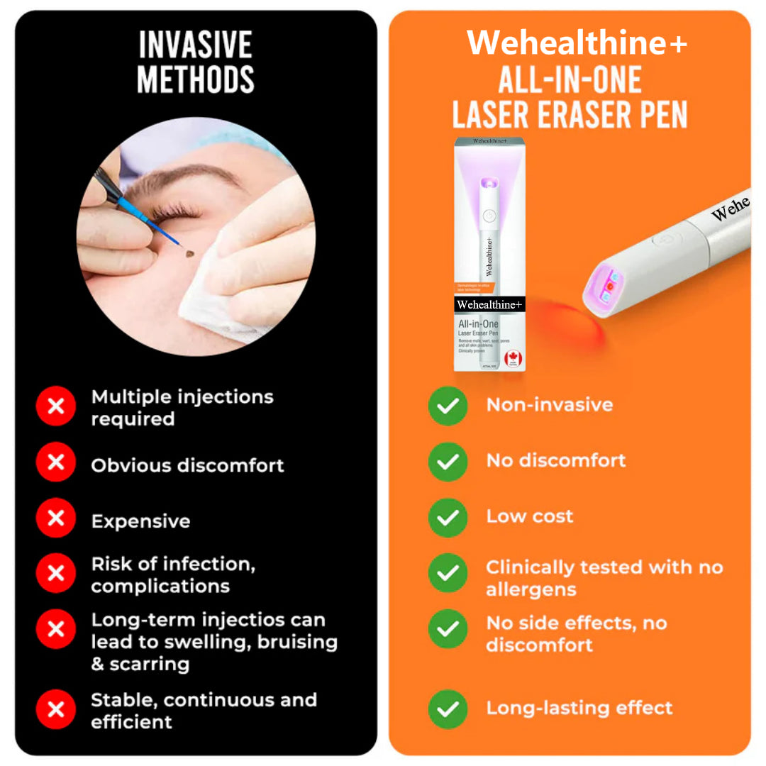 ☂Sparksalezoner® VelvetSkin+Series ⚔️All-in-One Laser Eraser Pen🖊️ (🔬Powered by CO₂ laser technology – effectively removes moles, warts, skin tags, pigmentation spots, and other skin imperfections)