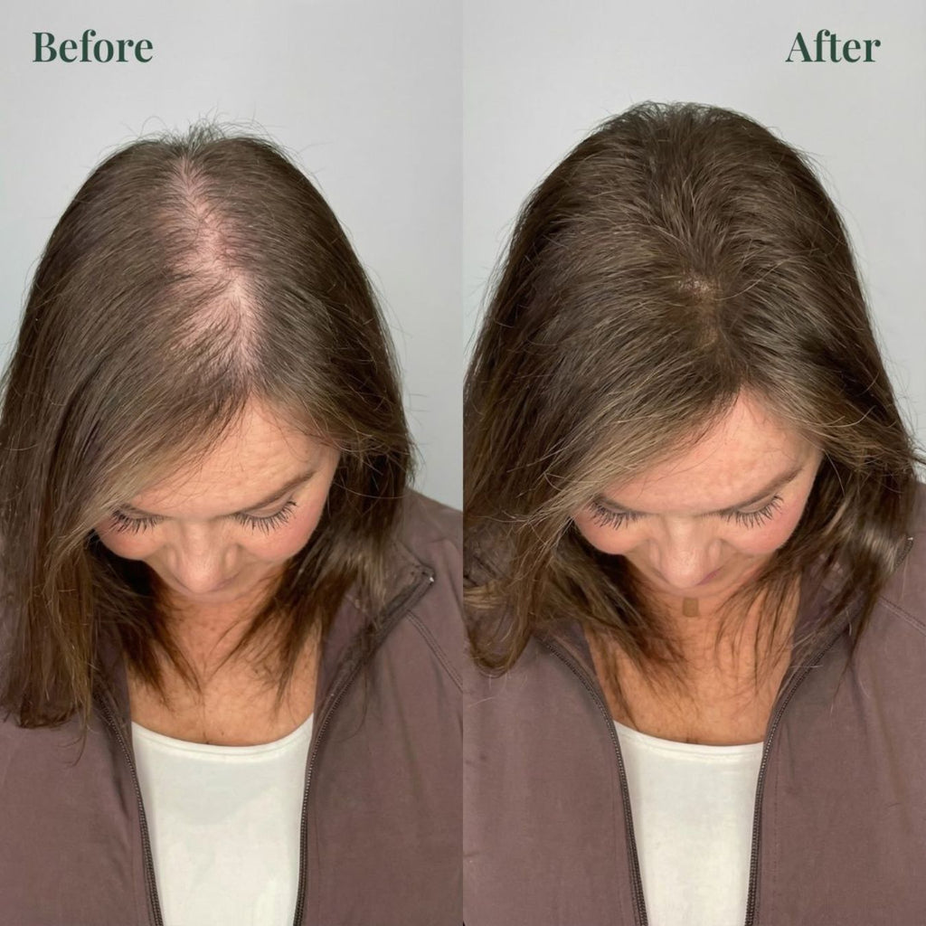 ✨Buy 1 Get 1 Free| Sparksalezoner™ Growth Support Shampoo