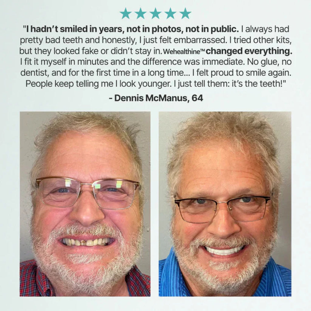 Ends Today: 70% OFF!Sparksalezoner™? Custom-Fit Full Functional DenturesMake you more confident