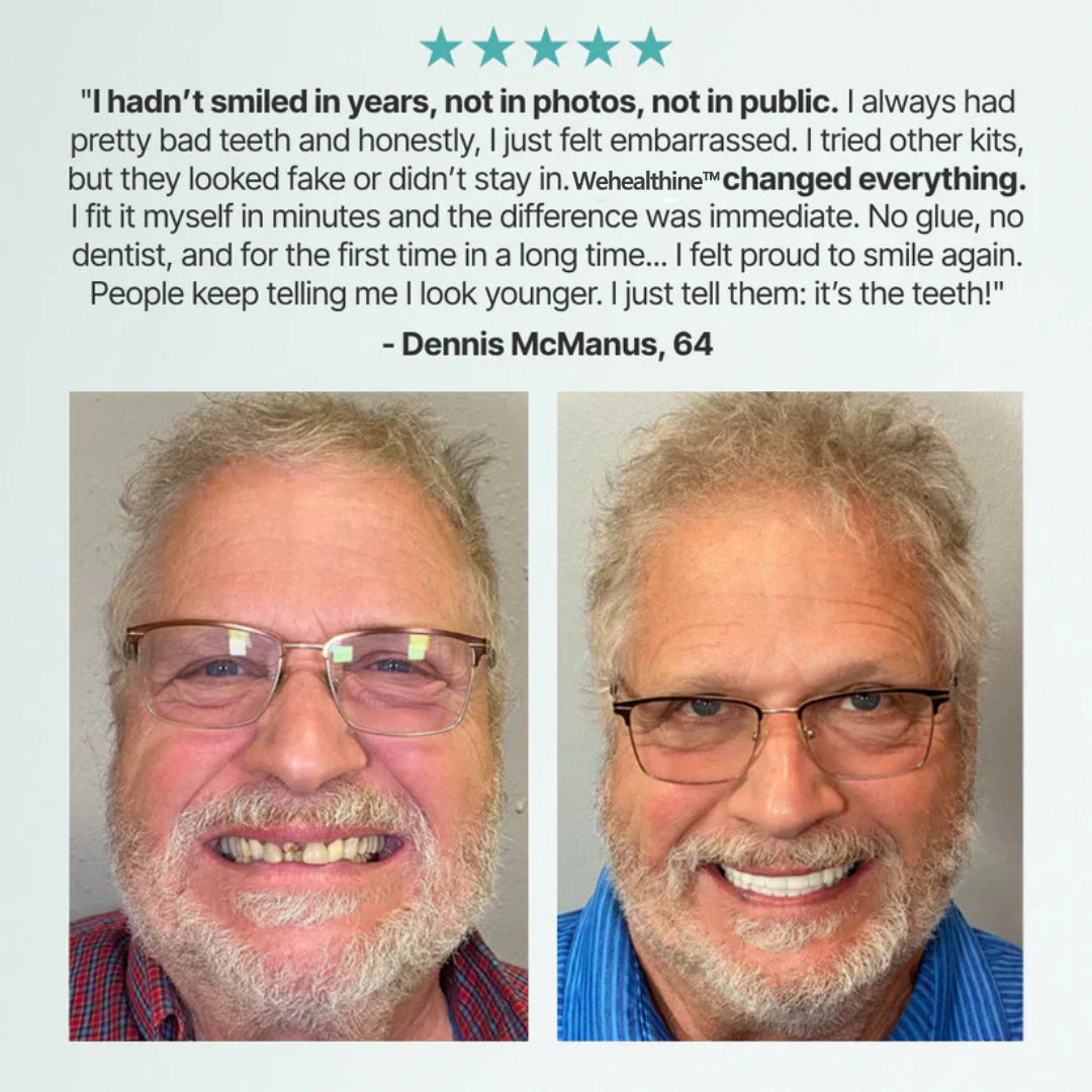 Ends Today: 70% OFF!Sparksalezoner™? Custom-Fit Full Functional DenturesMake you more confident