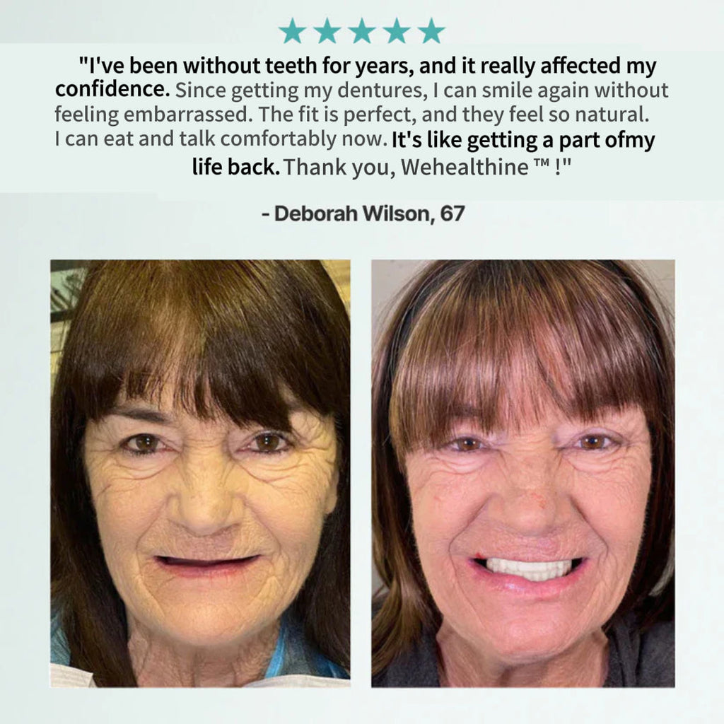 Ends Today: 70% OFF!Sparksalezoner™? Custom-Fit Full Functional DenturesMake you more confident