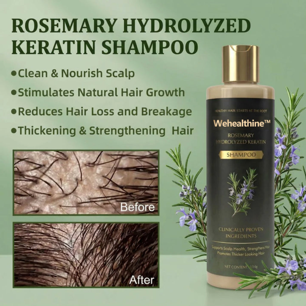 ✨Buy 1 Get 1 Free| Sparksalezoner™ Growth Support Shampoo