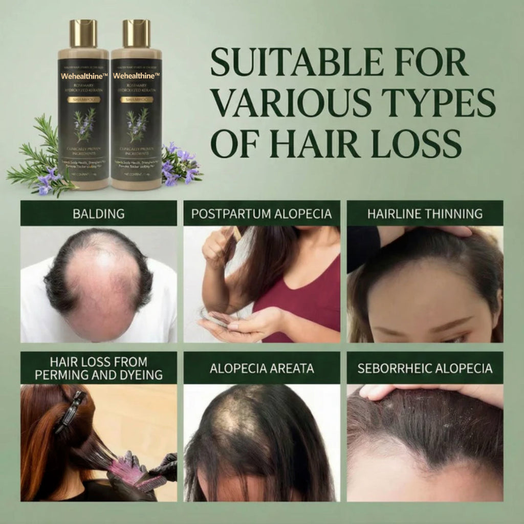 ✨Buy 1 Get 1 Free| Sparksalezoner™ Growth Support Shampoo
