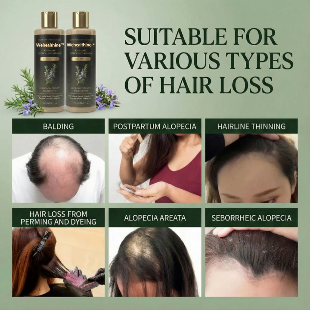 ✨Buy 1 Get 1 Free| Sparksalezoner™ Growth Support Shampoo