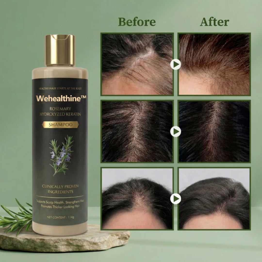 ✨Buy 1 Get 1 Free| Sparksalezoner™ Growth Support Shampoo